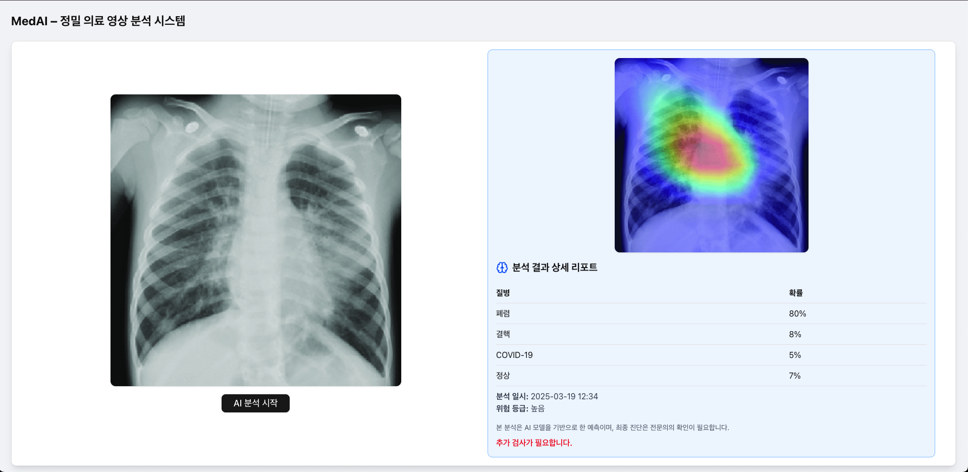 MedAI Vision (의료 영상 AI 분석)